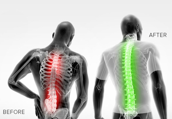 ropa moldeadora hombres dolor espalda